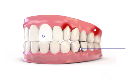 teethGum01
