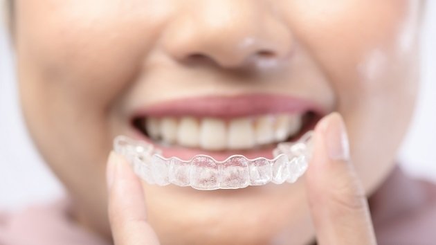 Invisalign